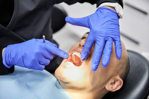 Best Emergency Tooth Extraction in Auburn, GA