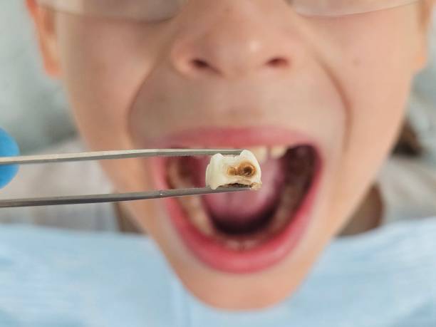 Best Weekend Emergency Dentist in Auburn, GA