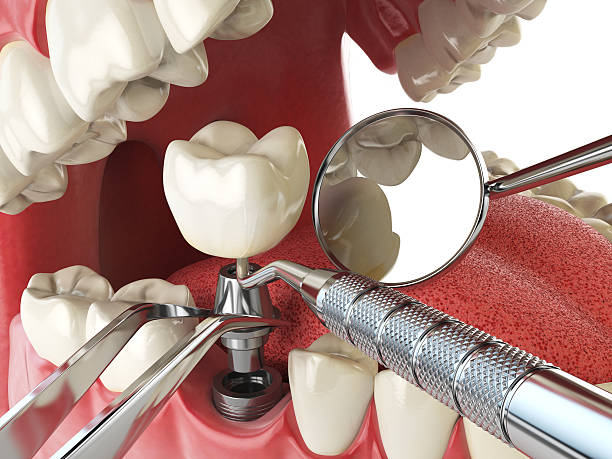 Best Weekend Emergency Dentist in Auburn, GA