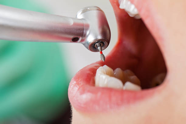 Best Pediatric Emergency Dentist in Auburn, GA